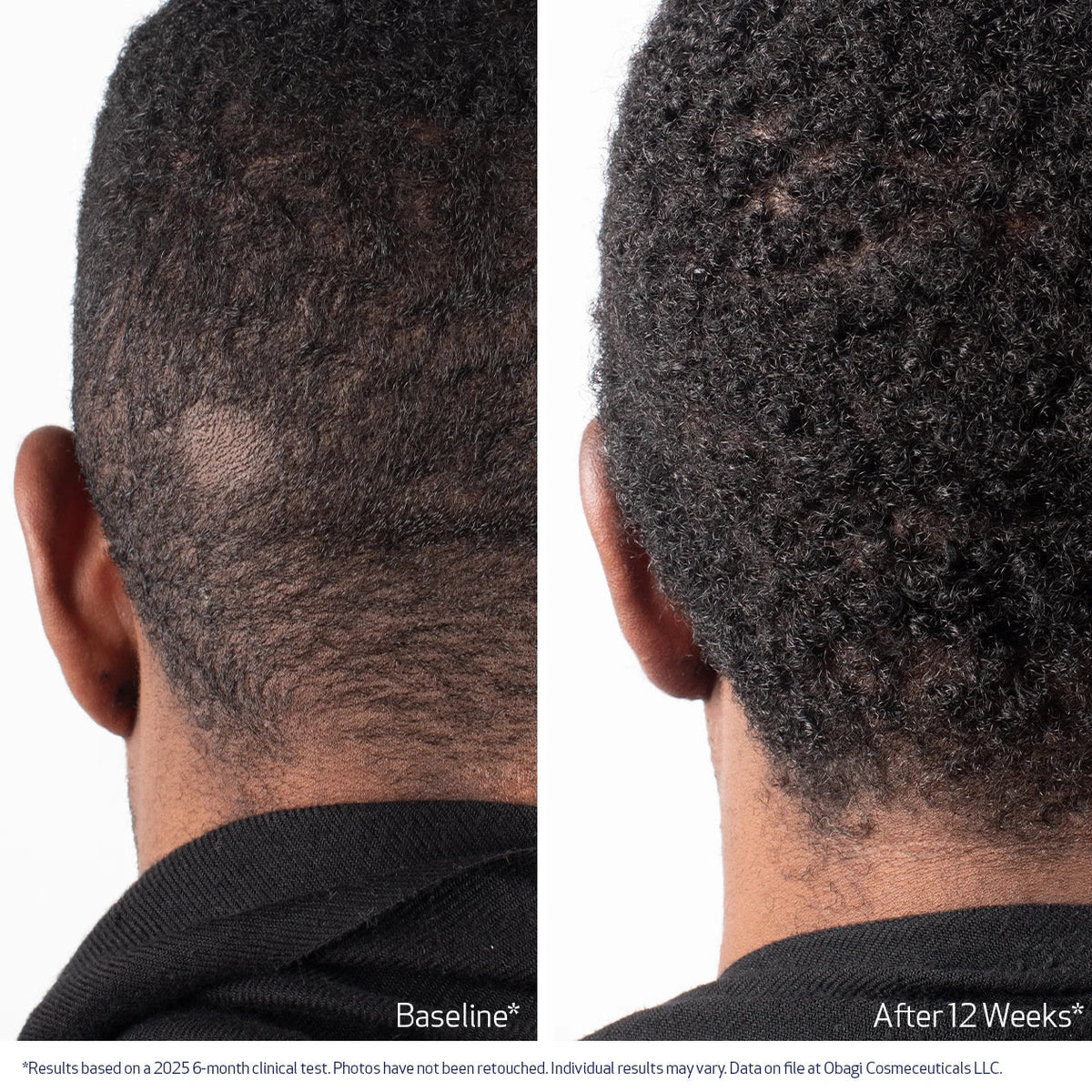 Nu-Cil BioStim Scalp Serum