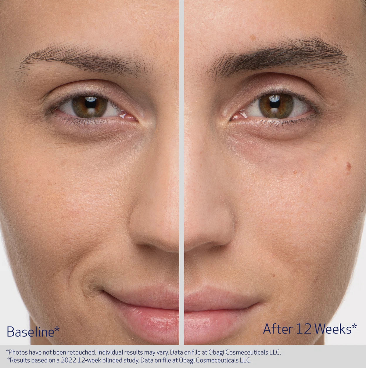 Nu-Cil™ Eyebrow Enhancing Serum