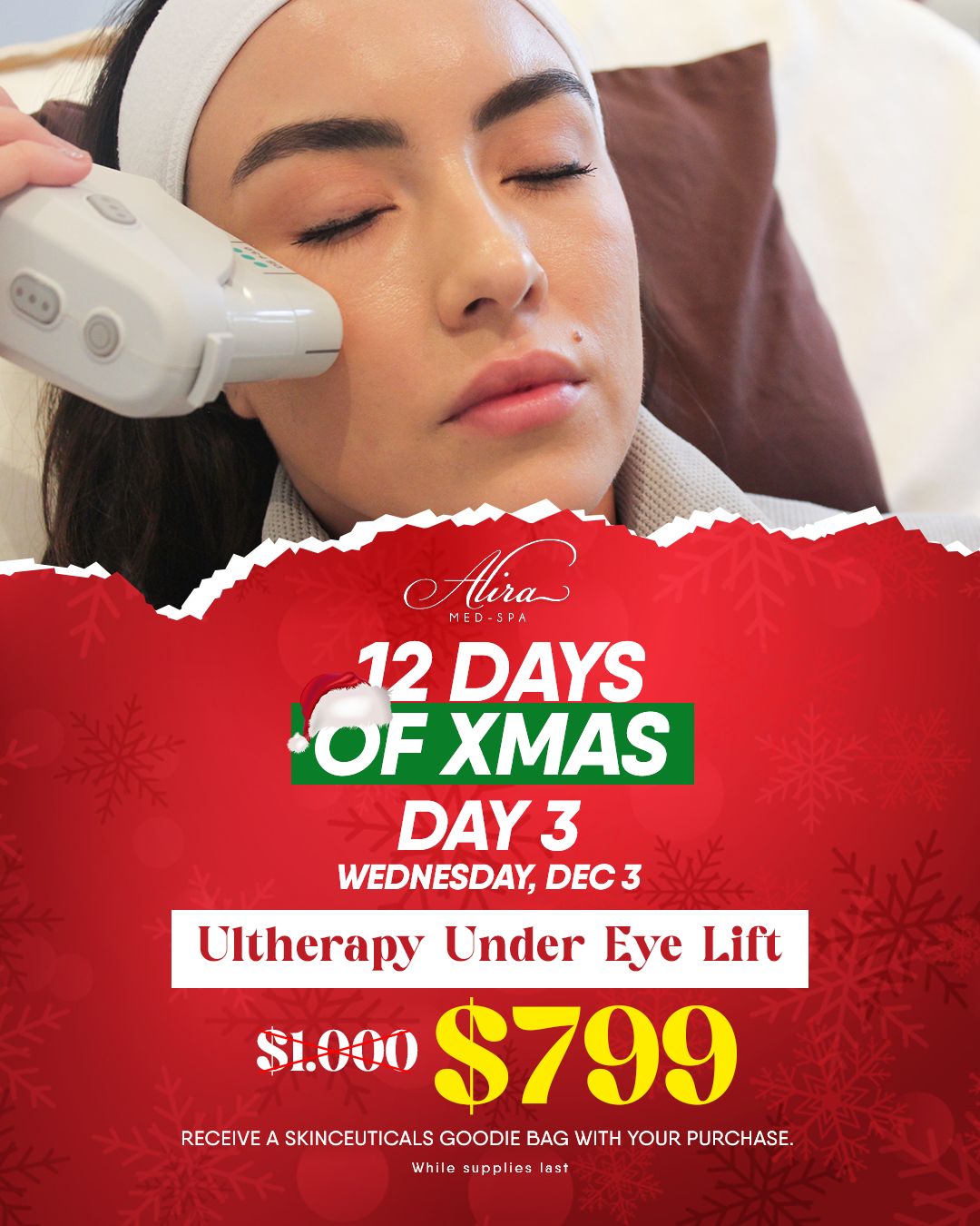12 Days of Christmas: Ultherapy Under Eye Lift