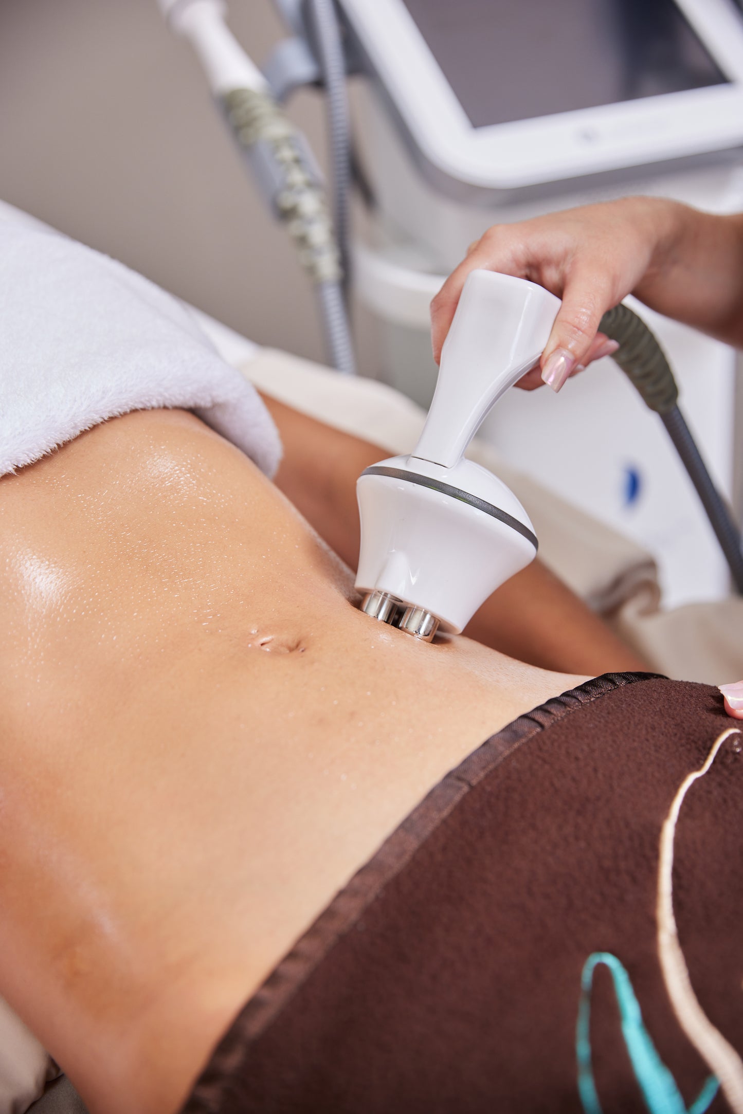 New Year New You: LegendPro Radiofrequency Microneedling Body Sculpt