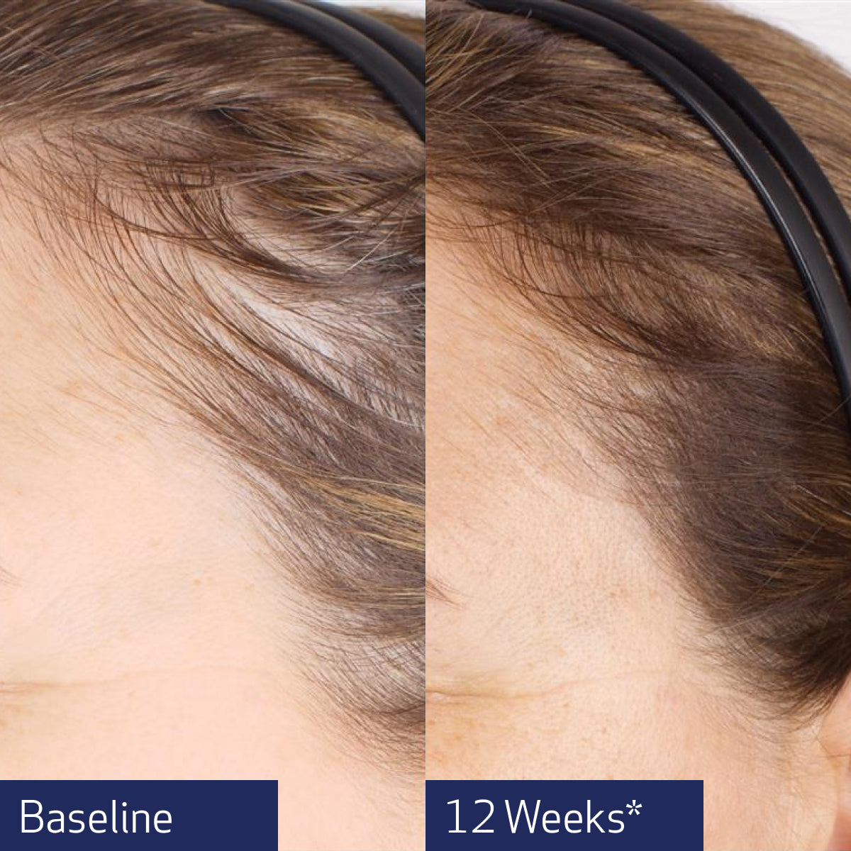 Nu-Cil BioStim Scalp Serum