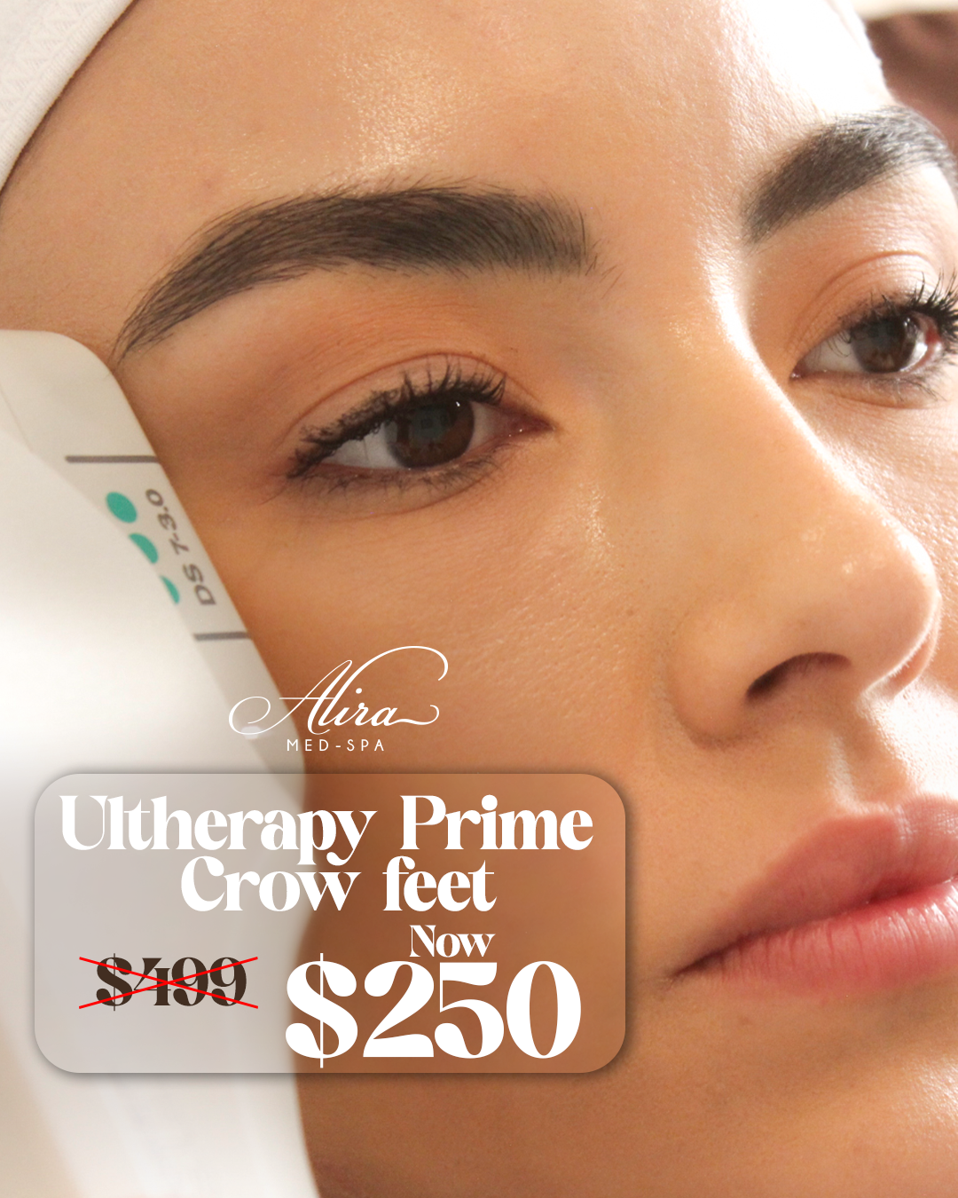 Ultherapy Prime Sale